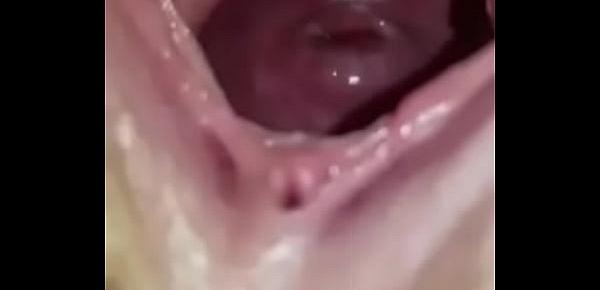  Wide open pussy low cervix